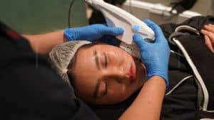 Apa Itu Ultherapy Prime Perawatan Ultrasound untuk Membantu Lifting Kulit Tanpa Operasi