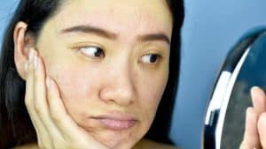 Kulit Kusam dan Kering Penyebab, Cara Merawat, dan Pilihan Treatment yang Bisa Dipertimbangkan